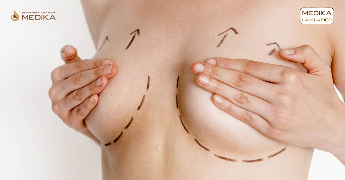 Chế độ ăn uống sau phẫu thuật nâng ngực chảy xệ ở MEDIKA chuyên gia nâng ngực