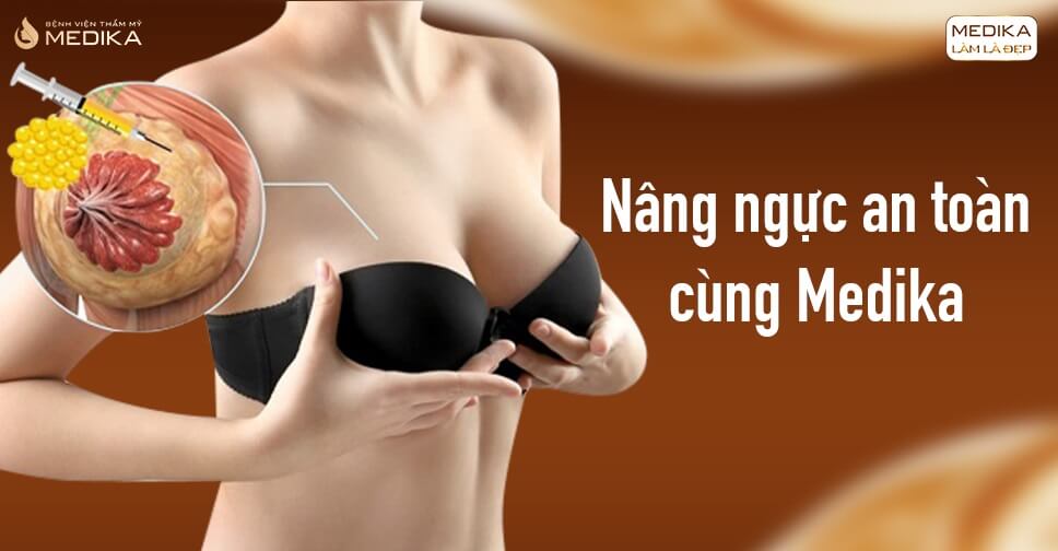 Nâng ngực an toàn - Lựa chọn hoàn hảo cùng MEDIKA - Chuyengianangnguc.vn
